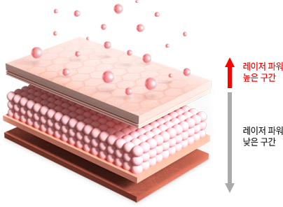 기존레이저 세포 이미지