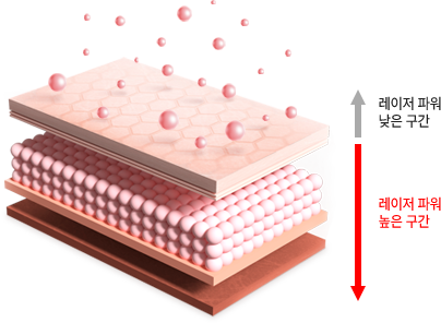 기존레이저 세포 이미지